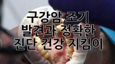 구강암 조기 발견과 정확한 진단: 건강 지킴이